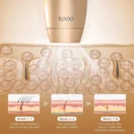 IPL Hair Removal Device Original for Permanent Hair Reduction | IPL hair removal, laser epilator, painless hair removal - Image 6