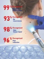 Wart Removal Pen Original for Fast Wart Treatment | wart remover, skin tag remover, wart treatment - Image 3
